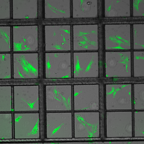 Live cell imaging and screening of T cells
